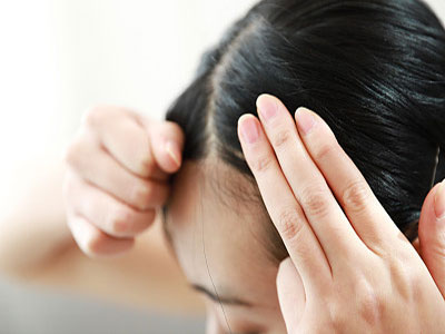 独家首发，最新脱发治疗技术重塑自信魅力，告别秃顶困扰！