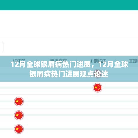 12月全球银屑病最新进展及观点论述