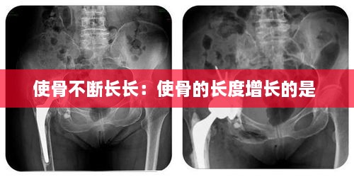 使骨不断长长：使骨的长度增长的是 