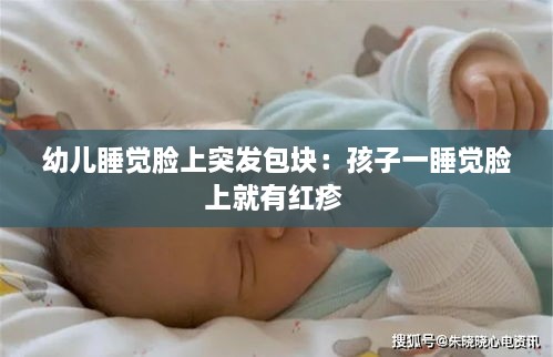幼儿睡觉脸上突发包块：孩子一睡觉脸上就有红疹 