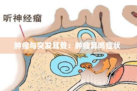 肿瘤与突发耳聋：肿瘤耳鸣症状 