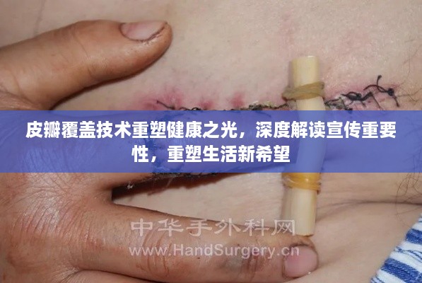 皮瓣覆盖技术重塑健康之光，深度解读宣传重要性，重塑生活新希望