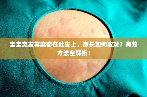 宝宝突发荨麻疹在肚皮上，家长如何应对？有效方法全解析！