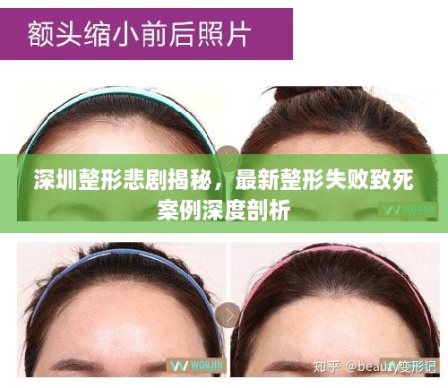 深圳整形悲剧揭秘，最新整形失败致死案例深度剖析